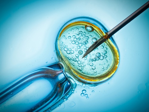 Frozen Embryo Transfer